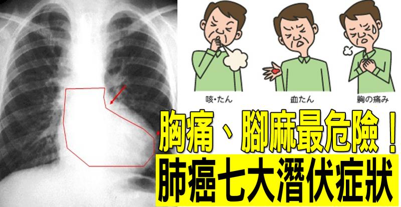 腳麻、胸痛、疲累?「肺癌」存活率不到5%,七大潛伏徵兆最危險
