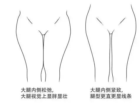 蘿蔔腿,大象腿不怕了,教你不同的腿型,不同的鍛煉方法,看看那個適合您!練起來,一周瘦大腿