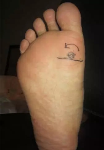 腰疼、頸椎疼、膝蓋疼,一病一絕招!不錯~值得一看!