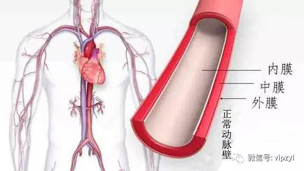 背痛一天,竟突然離世,醫生都措手不及,這病真的太兇險,千萬要注意了!