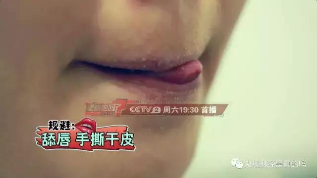 嘴唇脫皮、皸裂一定別輕視!或是疾病信號