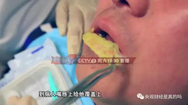 嘴唇脫皮、皸裂一定別輕視!或是疾病信號