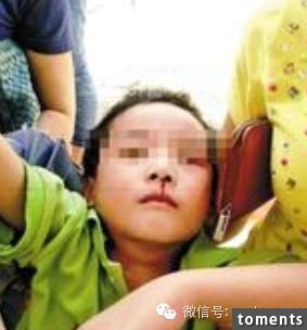 2歲幼兒因流鼻血昏了過去,心急的媽媽趕緊把孩子送到醫院,結果醫生卻宣告不治!當媽媽抓著醫生問為什麼,聽完解釋的她默默心冷