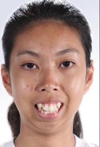 她「長太醜」沒朋友連工作都找不到!鐵了心大改造「3個月後再出現....」美到連爸媽都不認得!