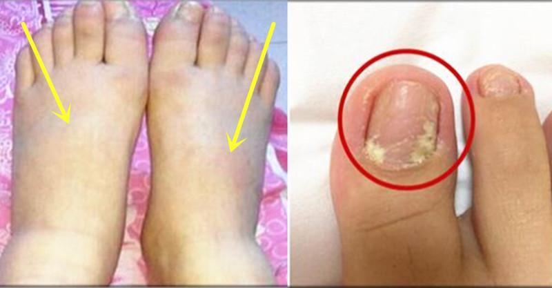 腳部的「這些變化」,都是疾病信號,你注意到了嗎?千萬不要忽視!