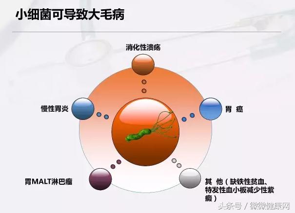 感染幽門螺旋桿菌,到發胃病患胃癌,需要多久?