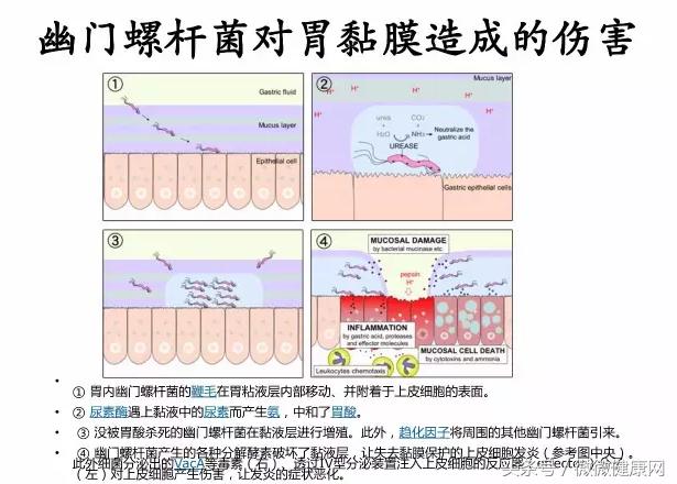 感染幽門螺旋桿菌,到發胃病患胃癌,需要多久?
