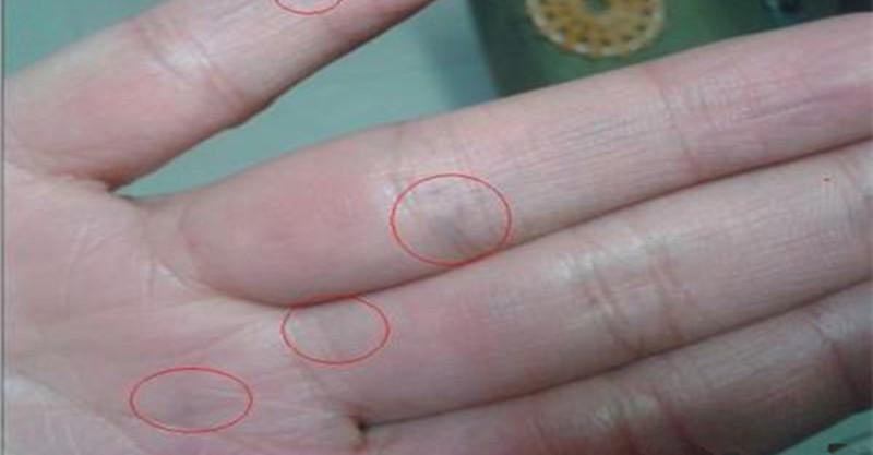 手掌泄露了你的身體秘密:手掌出現「這8種癥狀」或是大病的徵兆,你有嗎?