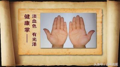 手掌泄露了你的身體秘密:手掌出現「這8種癥狀」或是大病的徵兆,你有嗎?