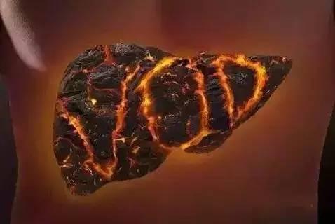 身上長這「2種痣」,要小心「肝臟病變」,最好去醫院檢查一下!