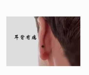 長在「這些地方」的黑痣最招財,有一顆財運亨通,身家千萬!