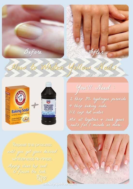 If you don't want to bother getting a full manicure (and who does?) you can simply clean up your nails with this simple recipe