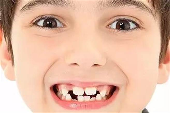 牙齒邊緣鋸齒狀(圖/萬花鏡)