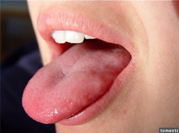 原來常咬到舌頭不是你不小心，是＂這種病＂的徵兆！要是一不小心可能就會.....千萬要注意！