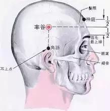 偏頭痛真要命，治癒卻很簡單！一付藥即可！