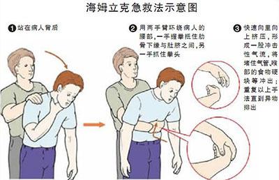 喉嚨被異物卡住千萬別拍背 成人孩童都適用的急救法