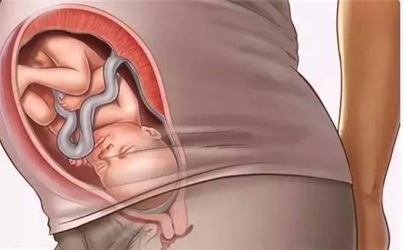 入盆是什麼感覺呢？六大症狀提示胎兒已入盆！