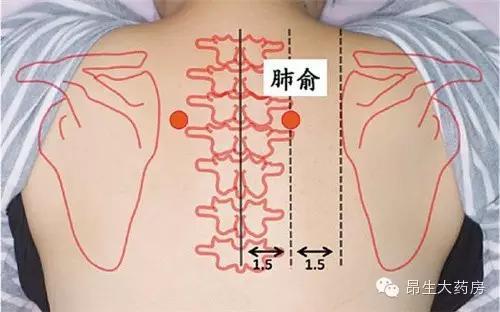 咳嗽不斷？慢性支氣管炎根治有良方！