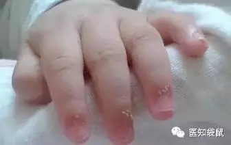 這樣給寶寶剪指甲的父母們，看看你錯在了哪？
