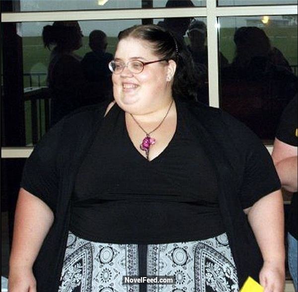 一名35歲女子通過手術瘋狂減重266斤，這項減肥手術卻帶來了嚴重的副作用，醫生不得不在她的咽喉下塞入了填充物...