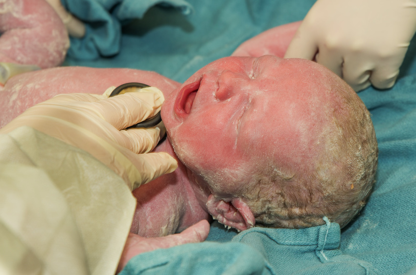 刚出生的小婴儿看起来很脏,妈妈却赶紧交代护士「千万