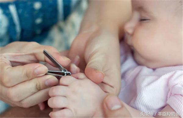 亂給寶寶剪指甲後果很嚴重，10個媽媽9個都剪錯了！