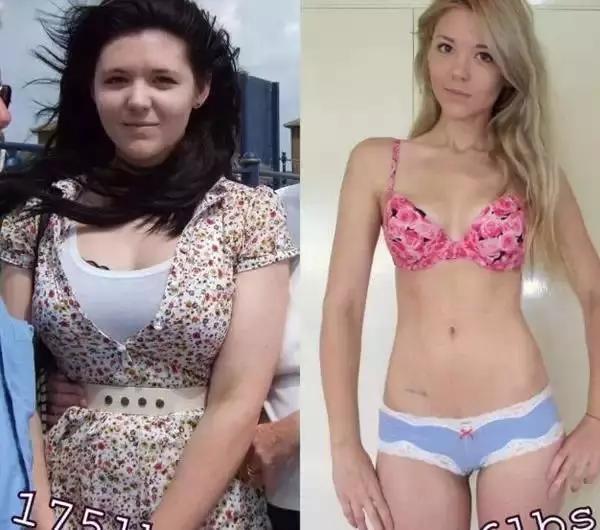 慎入：BBC解剖了一個200斤女子，看完你會用生命去減肥！