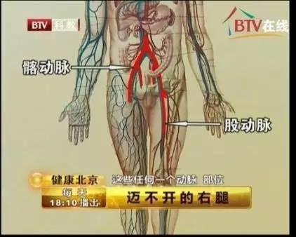 「血管堵塞」只要三步！「一個動作」就能知道你的血管是否堵了，趕緊來測測！