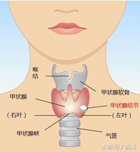 國際巨星李連傑因此病受盡折磨，甲狀腺功能亢進到底是一種什麼病