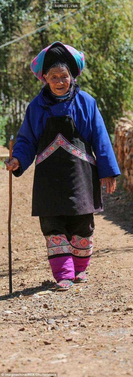 這位老奶奶是全中國「最後一位纏足婦女」，過去踩成「血肉模糊的腳掌」現在模樣讓人超心疼…