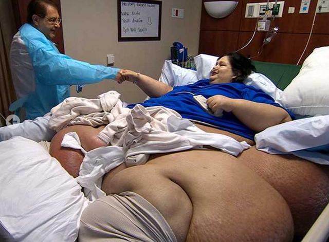450公斤女子「胖到無法下床」，她痛下定決心減肥...結果「甩肉375公斤」美到讓人認不出！ 