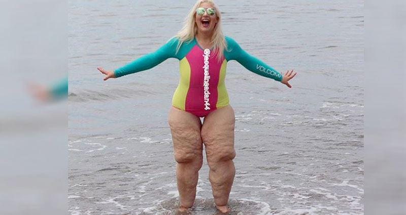 金髮正妹到海邊玩，露出「畸形象皮腿」讓眾人倒退三尺！解釋完原因後，網友紛紛向她道賀「真是恭喜妳」…