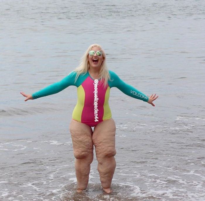 金髮正妹到海邊玩，露出「畸形象皮腿」讓眾人倒退三尺！解釋完原因後，網友紛紛向她道賀「真是恭喜妳」…