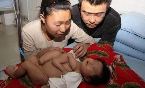 孩子一出生就抱著一具「屍體」把醫生給嚇壞了！經檢查後，沒想到竟然是.... 父母	 