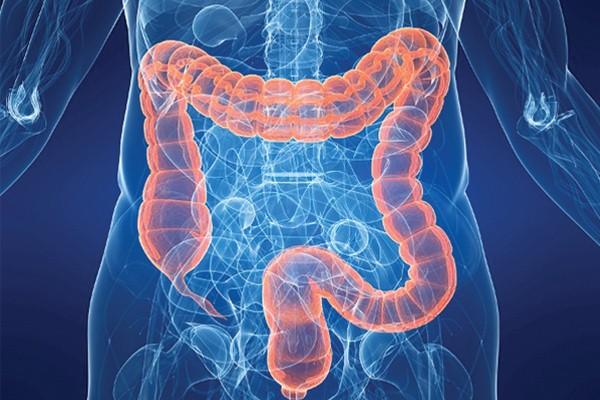80%的大腸癌發現時已是晚期，哪些症狀「暗示」大腸癌？