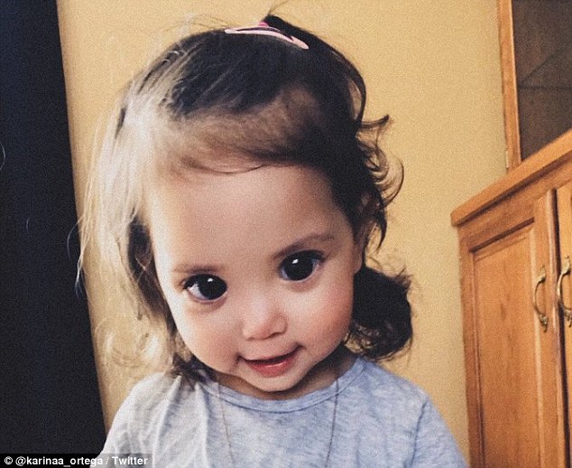 2歲小女娃「黑亮水汪汪大眼」爆紅全網　醫生「一眼看出不對勁」警醒全球父母：這有問題
