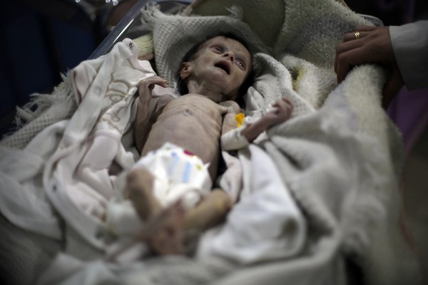 ▲敘利亞滿月小女嬰體重僅1900克，活活餓成乾屍。（圖／CFP）