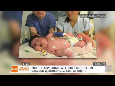 澳洲300公斤孕婦臨盆竟「出動直升機」！沒想到嬰兒出生後的模樣，連護士都嚇一大跳了！