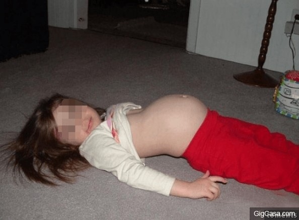 13歲小女孩突然懷孕，醫生檢查發現她肚子裡裝的是3隻恐怖的詭異生物