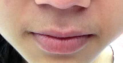 為什麼有的女性嘴邊會長出「小鬍子」？可以經常刮嗎？告訴你答案