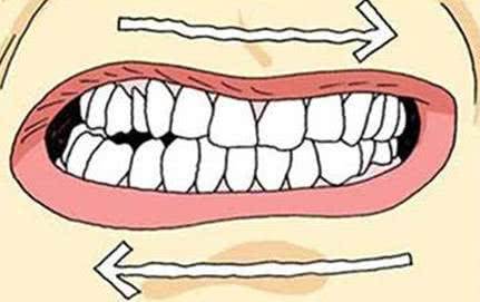 千萬別再做了！這6種最常見的習慣最傷牙，會讓你的牙齒早早掉光 !