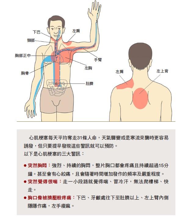 最常出现的疼痛部位在前胸部及偏左侧,然后延伸到左肩及上背部,颈部