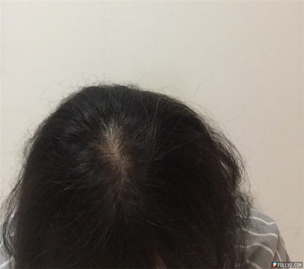 24歲才初戀「男友因圖上這個原因想分手」，網友一看全驚呆：「這種理由我這輩子沒見過」！