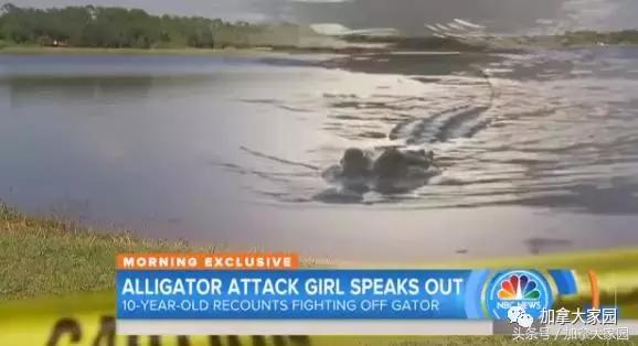 10歲女童被鱷魚咬住腿！生死之間，她突然有一個瘋狂想法～