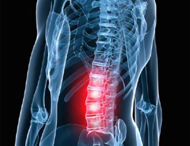 腰背部酸痛、肩膀疼痛、便秘居然是骨盆變形惹的禍···