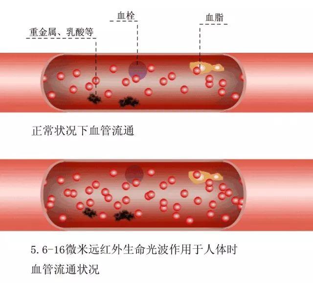 人過四十五，就怕血管堵！保持這些習慣可以清血管！