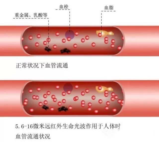 血管堵塞有多可怕？！醫生苦勸：別再讓這6大壞習慣偷走健康！