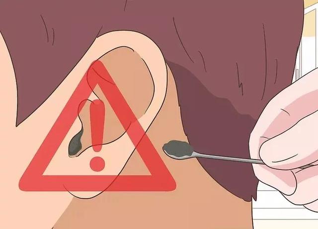 耳朵癢就是耳屎多？其實是暗示了身體這8種狀況