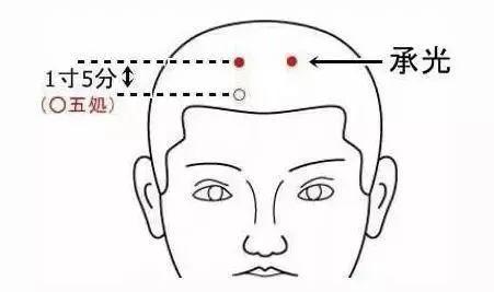 老年侃健康丨頭上有個「不老穴」，每天拍打1分鐘，眼睛不花用到老