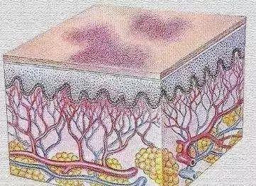 為什麼你的身上會無緣無故出現淤青？這4種情況最要命，一定注意